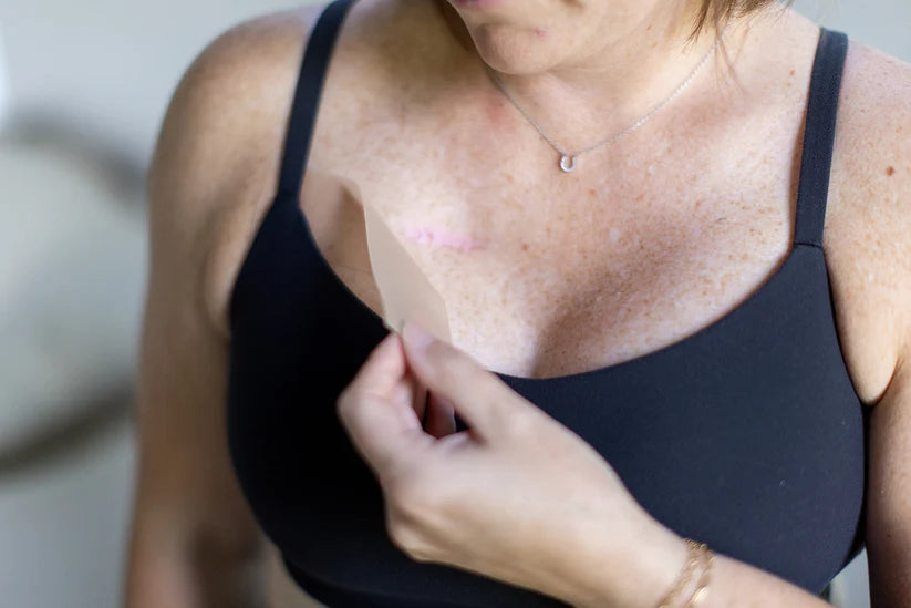 RecoverEase Silicone Scar Strips