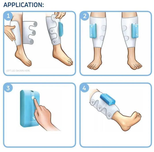 DVT Leg Compression Device